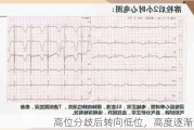 高位分歧后转向低位，高度逐渐降低