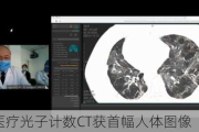 东软医疗光子计数CT获首幅人体图像