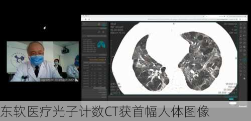 东软医疗光子计数CT获首幅人体图像