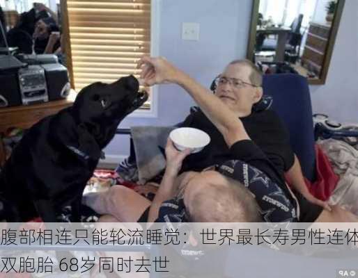 腹部相连只能轮流睡觉：世界最长寿男性连体双胞胎 68岁同时去世