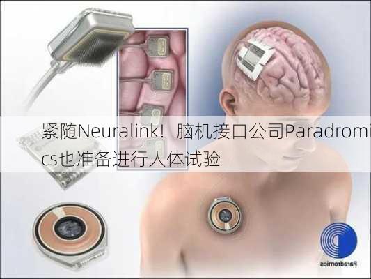 紧随Neuralink！脑机接口公司Paradromics也准备进行人体试验