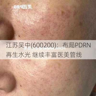 江苏吴中(600200)：布局PDRN再生水光 继续丰富医美管线