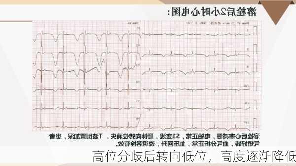 高位分歧后转向低位，高度逐渐降低